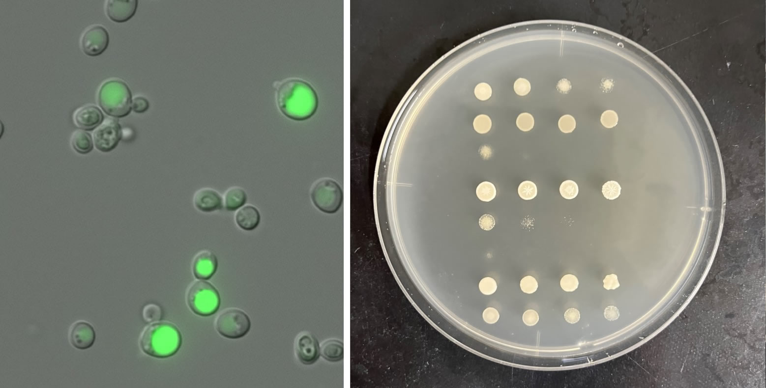 （左）酵母細胞を蛍光光学顕微鏡で観察したもの。（右）スポットアッセイにより各種酵母の生育度合の違いを調べた寒天培地プレートの写真。