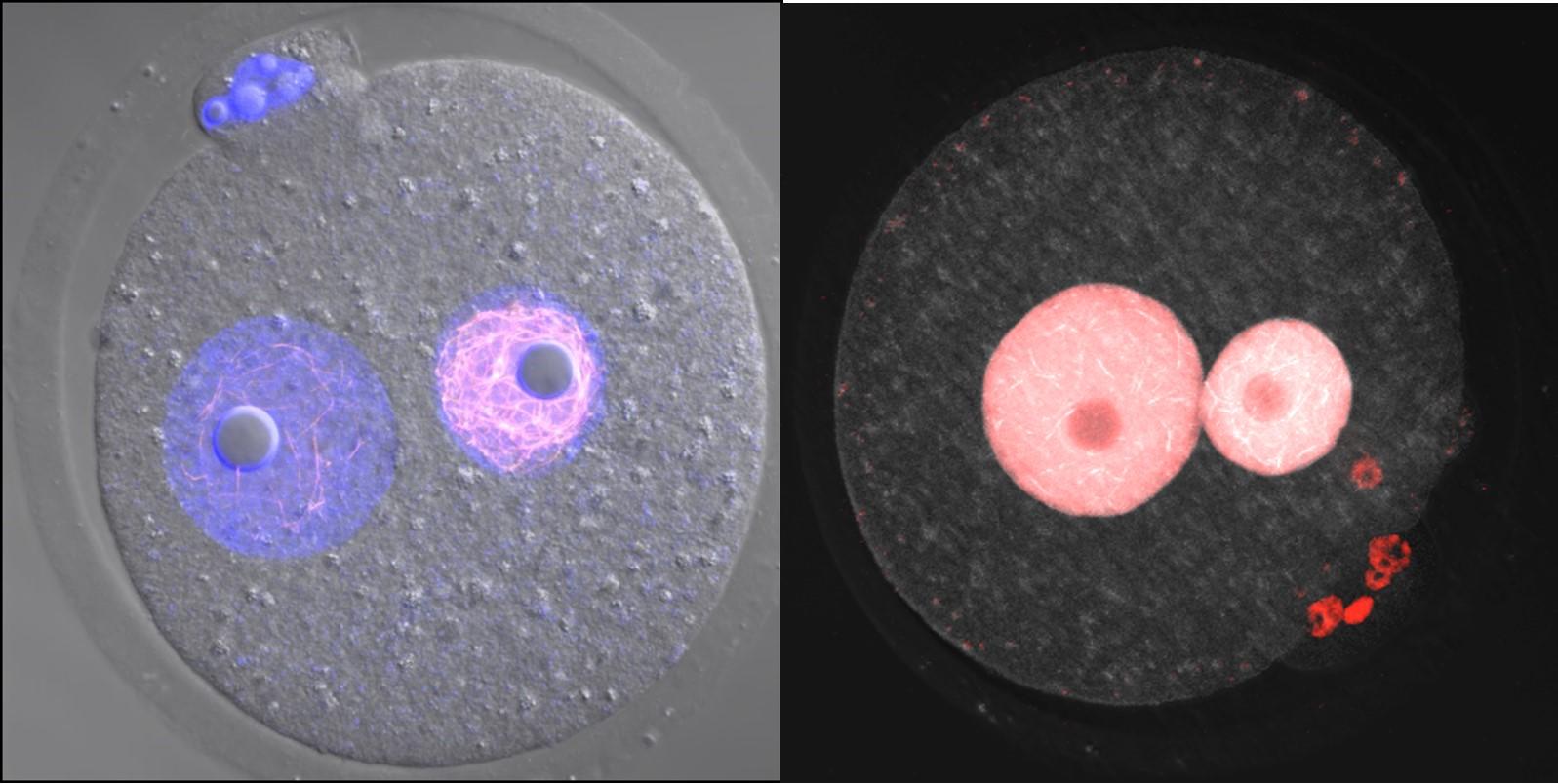 Discovery of Novel Nuclear Structure Inside Fertilized Eggs - Research Results Bring Us Closer to Solving the Riddle of the Development of Animals -- Kindai University