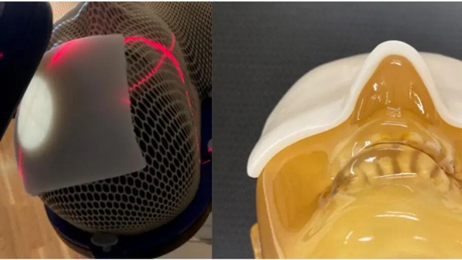 Developed a novel, "Soft Rubber Bolus" for radiation therapy - Easily shapable by hand, leading to high-precision irradiation and more adapted treatment -- Kindai University