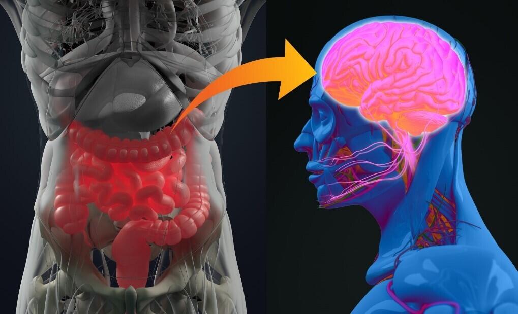 Curcumin prodrug CMG has beneficial effects on a mouse model of multiple sclerosis by modulating the gut flora -- Kindai University