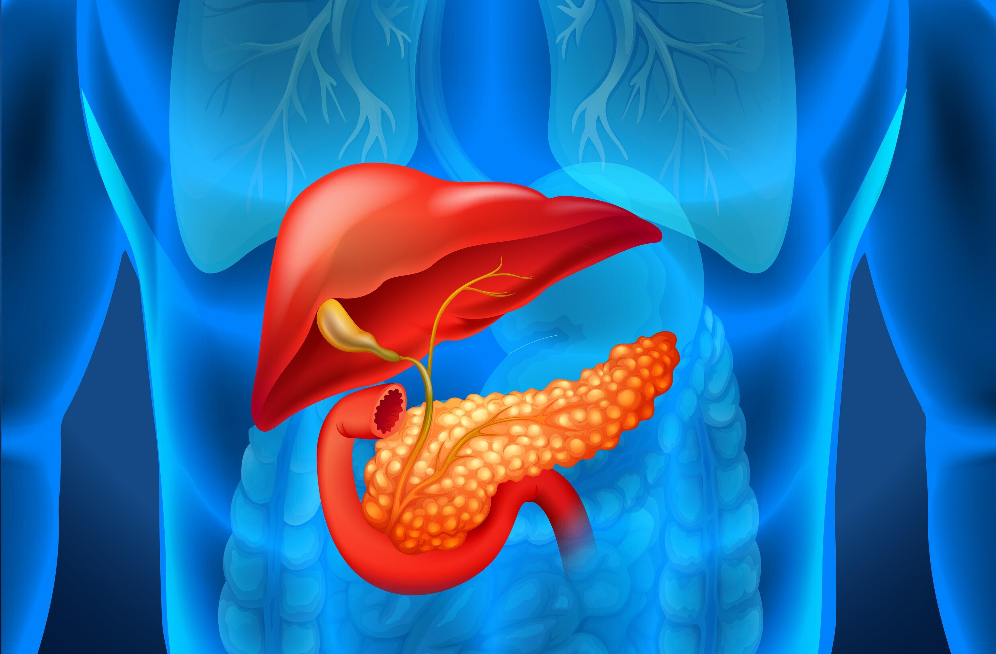 Discovered "GT-7" compound induces cell death in pancreatic cancer cells - Expected for a new treatment approach different from the mechanisms of conventional anticancer drugs