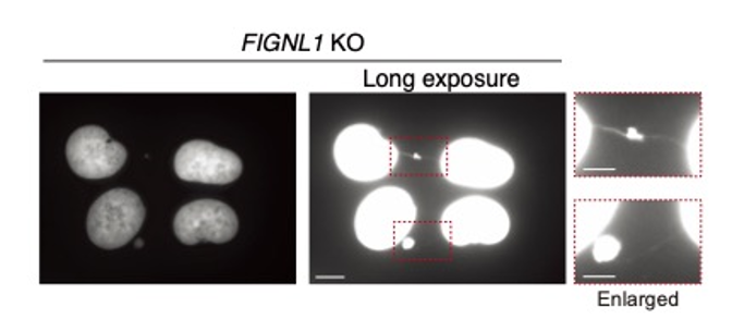 Studying the intricacies of homologous recombination and abnormal chromosome bridges -- Kindai University