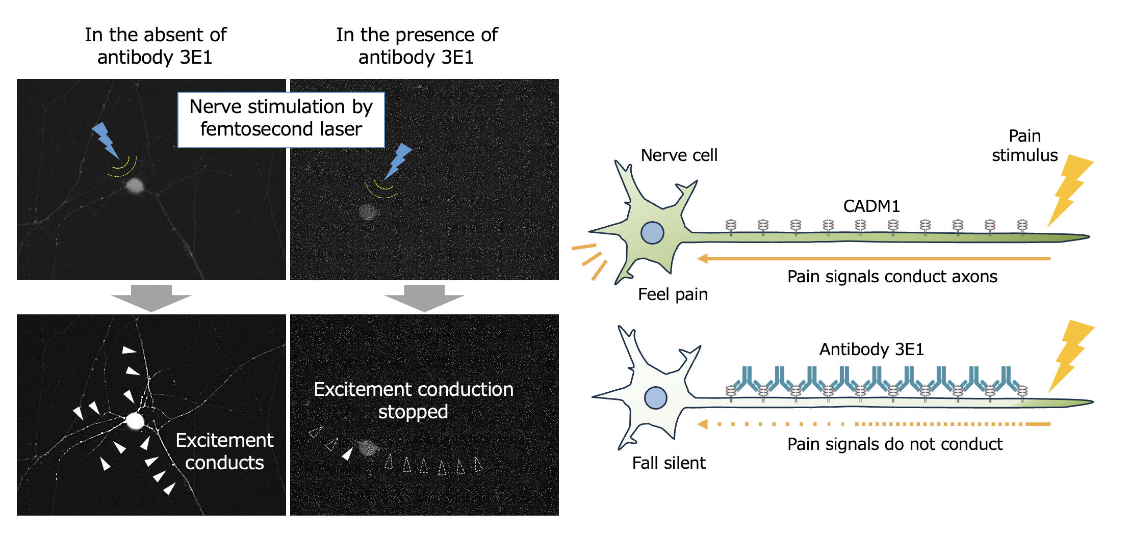 New antibody targeting nerve cells offers long-lasting pain relief -- Kindai University