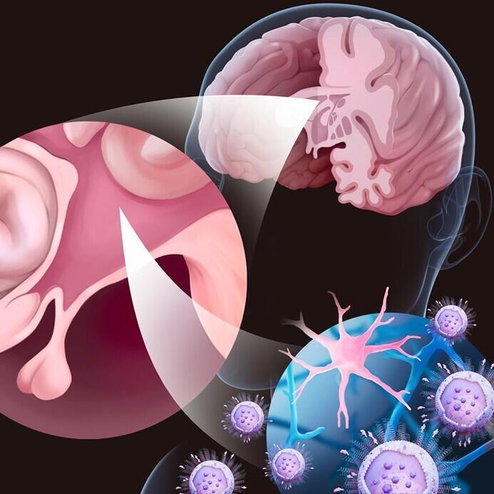 Arginine supplementation curbs Alzheimer's disease pathology in animal models