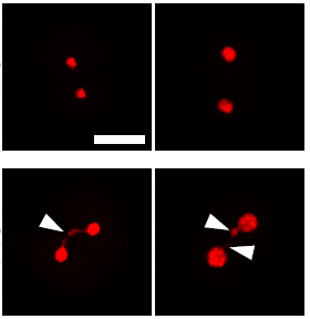 Chromosome segregation error during early cleavage in mouse pre-implantation embryo does not necessarily cause developmental failure after blastocyst stage (Source: Scientific Reports)