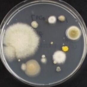 Kindai University verifies bacteria and fungi adhering to used masks | Science Japan
