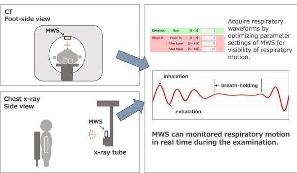 Revolutionary Breakthrough: Non-Contact Respiratory Motion Monitoring System Transforms X-ray and CT Imaging | Bioengineer.org