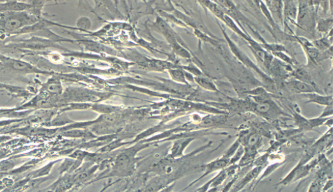 Fibroblast from human fetal lungs