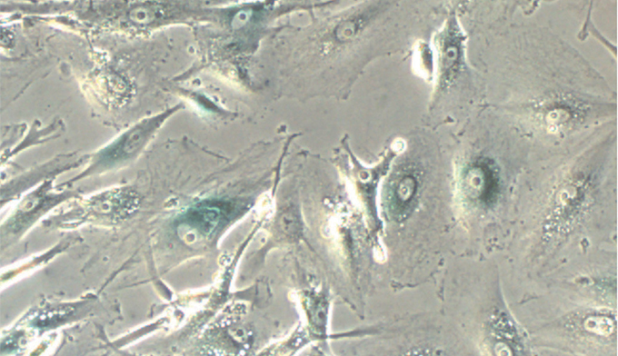 Fibroblast induced to cellular senescence thru genetic manipulation