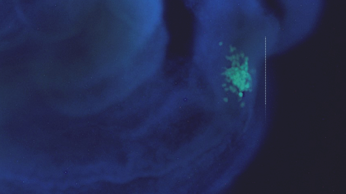 マウスの胚に定着したヒト多能性幹細胞(緑色の細胞)