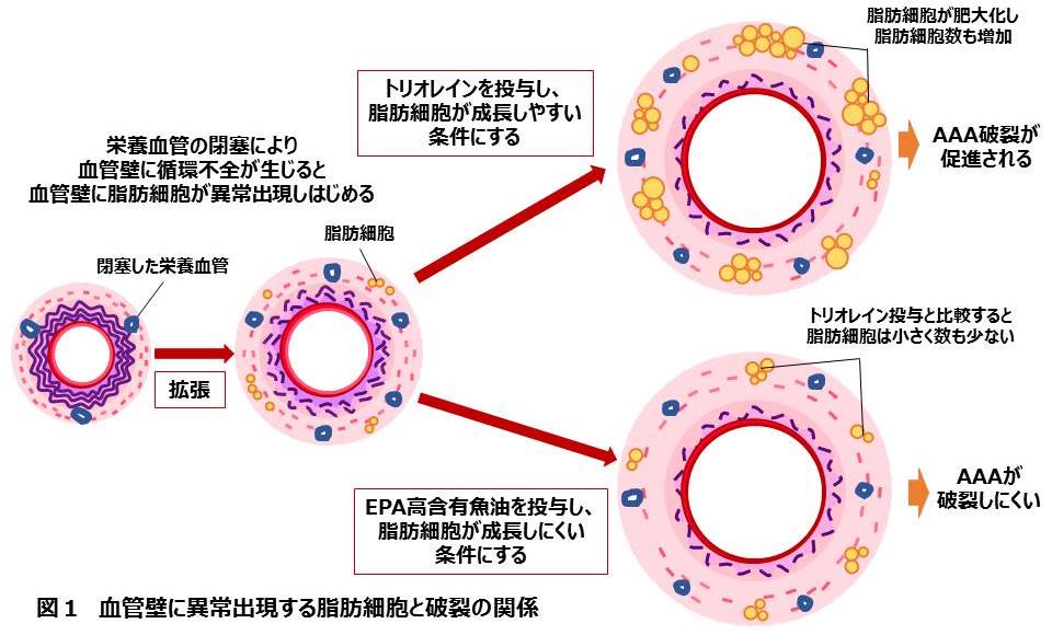 腹部大動脈瘤の破裂機構を解明　農学部応用生命化学科　准教授　財満信宏らの研究チーム　血管壁内の脂肪細胞が原因　予防薬・機能性食品開発に期待