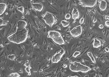 従来のES/iPS細胞と異なる新規多能性細胞－領域選択型エピ幹細胞－を樹立！ 近畿大学農学部バイオサイエンス学科