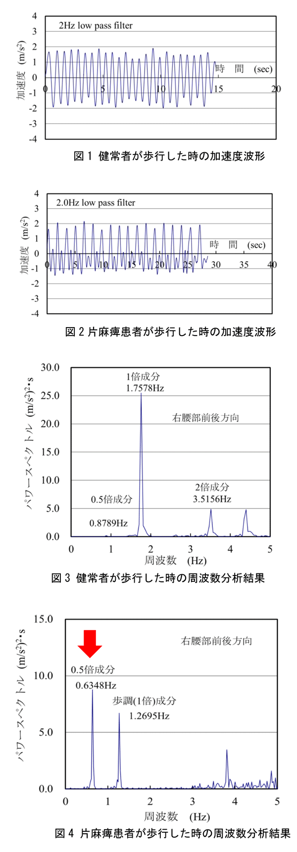 片麻痺歩行の定量的評価手法を開発　リハビリテーション医療に新しい一手　近畿大学理工学部