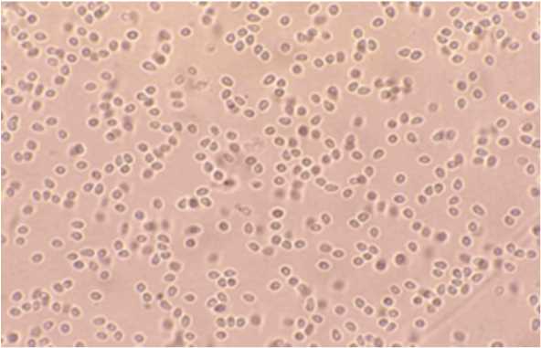 ブリ類のべこ病に有効な治療法を開発