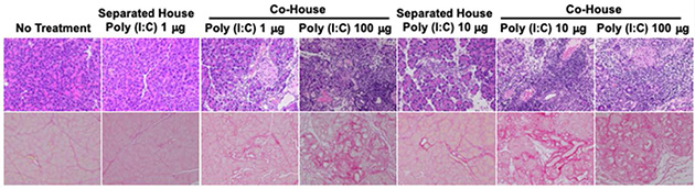 腸内フローラの変化による自己免疫性膵炎の発症メカニズムを解明　新たな治療法の開発へ期待