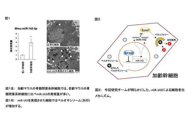 再生医療に使われる骨髄間葉系幹細胞の新しい老化メカニズムを発見　細胞老化を抑制するなど、再生医療技術の発展の可能性