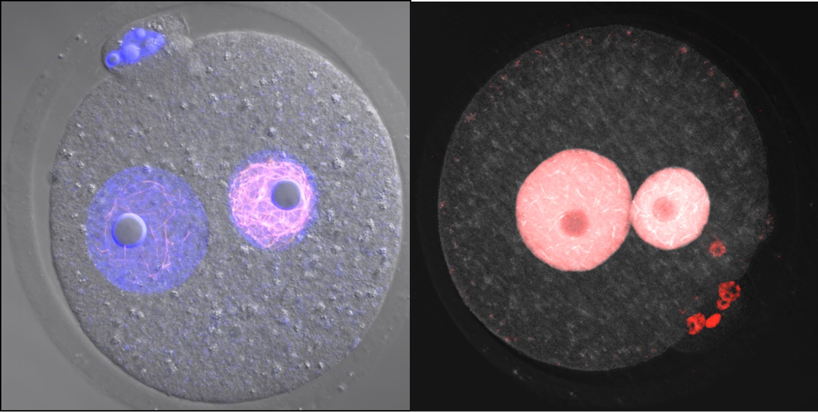 世界初！命の始まりである受精卵に新たな核構造を発見　動物発生の謎に迫る研究成果