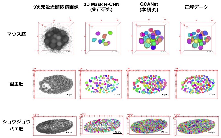 生殖補助医療につながる革新的AI開発に成功　－不妊症の原因となる卵子の質の評価に応用可能－