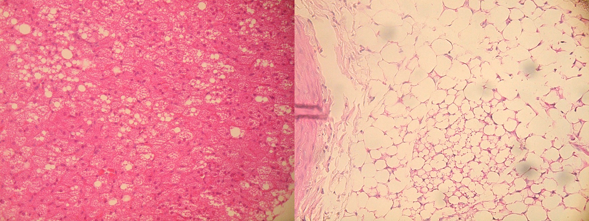 脂肪分と糖分の過剰摂取では血管異常の発生部位が異なることを発見　新たな血管疾患予防法の開発に期待