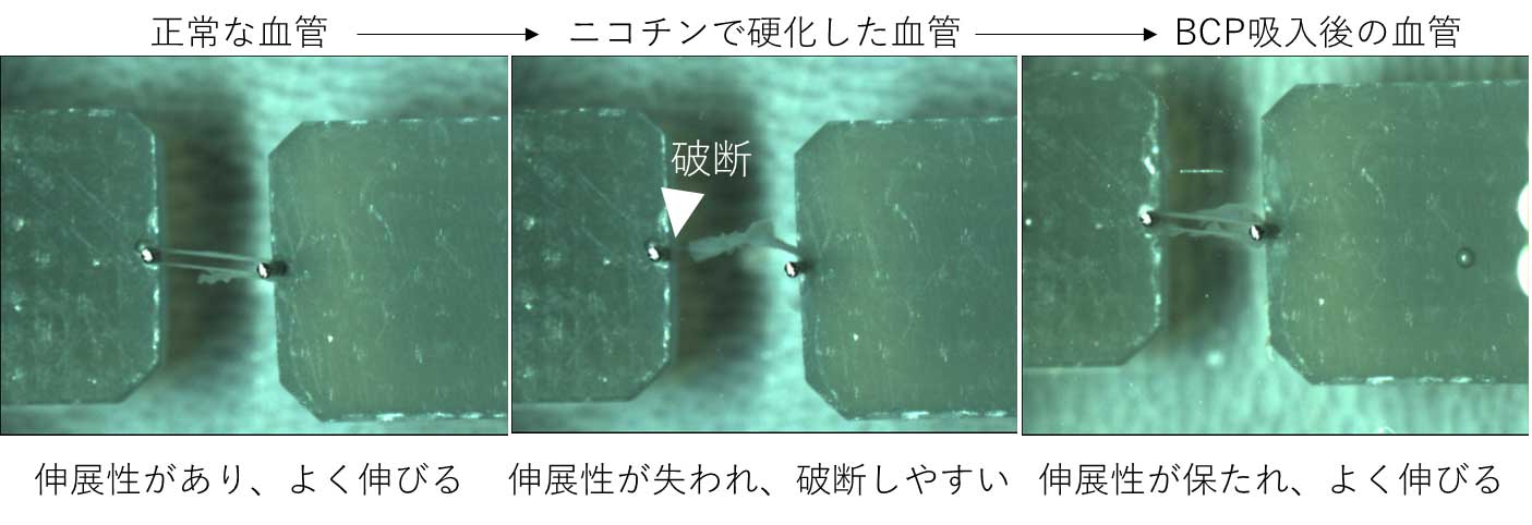 香り成分「&beta;-カリオフィレン」の吸入に血管保護効果があることを発見　ニコチンによる動脈硬化の抑制効果にも大きな期待