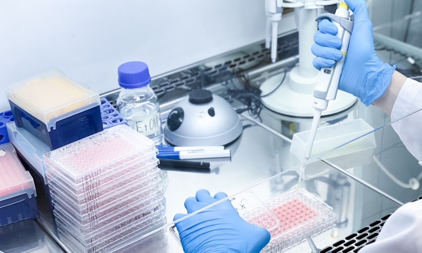 臨床とがん細胞株データベースでは、薬剤感受性の解析結果に差異がデータベースを用いた薬剤開発の限界を示唆する研究成果