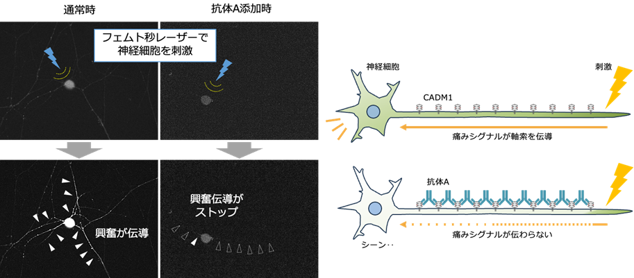 体内で神経に集積して疼痛を抑制する抗体を独自に作製　長時間効果を発揮する鎮痛薬への応用に期待