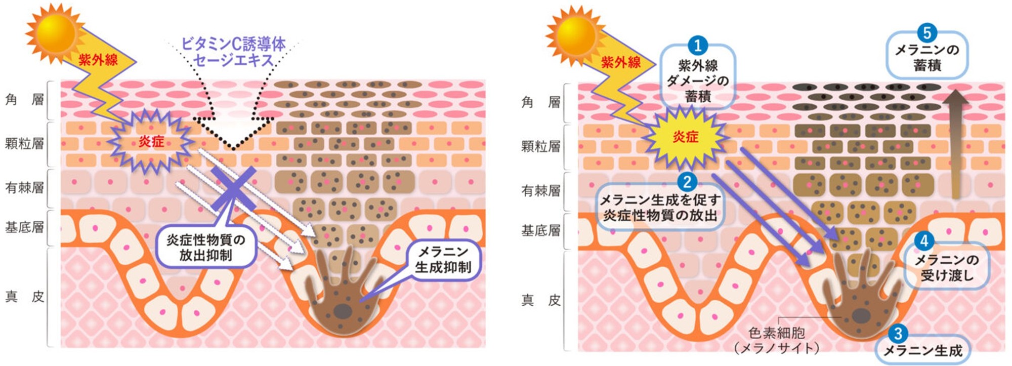 ＜国際学術誌「PLOS One」に掲載＞ビタミンC誘導体・セージエキスに関する新知見　～シミの一因"慢性炎症"を防ぐ世界初のシミ対策～