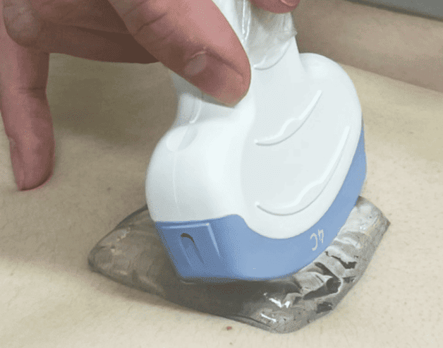 ベタつかない、拭き取り不要な超音波診断用のゲルパッドを開発　今後臨床応用することで、検査時の患者満足度向上に期待