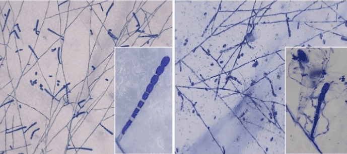 世界初！菌寄生菌による農薬耐性うどんこ病菌の感染拡大防止を確認　うどんこ病防除法の開発と農薬使用量の低減に期待